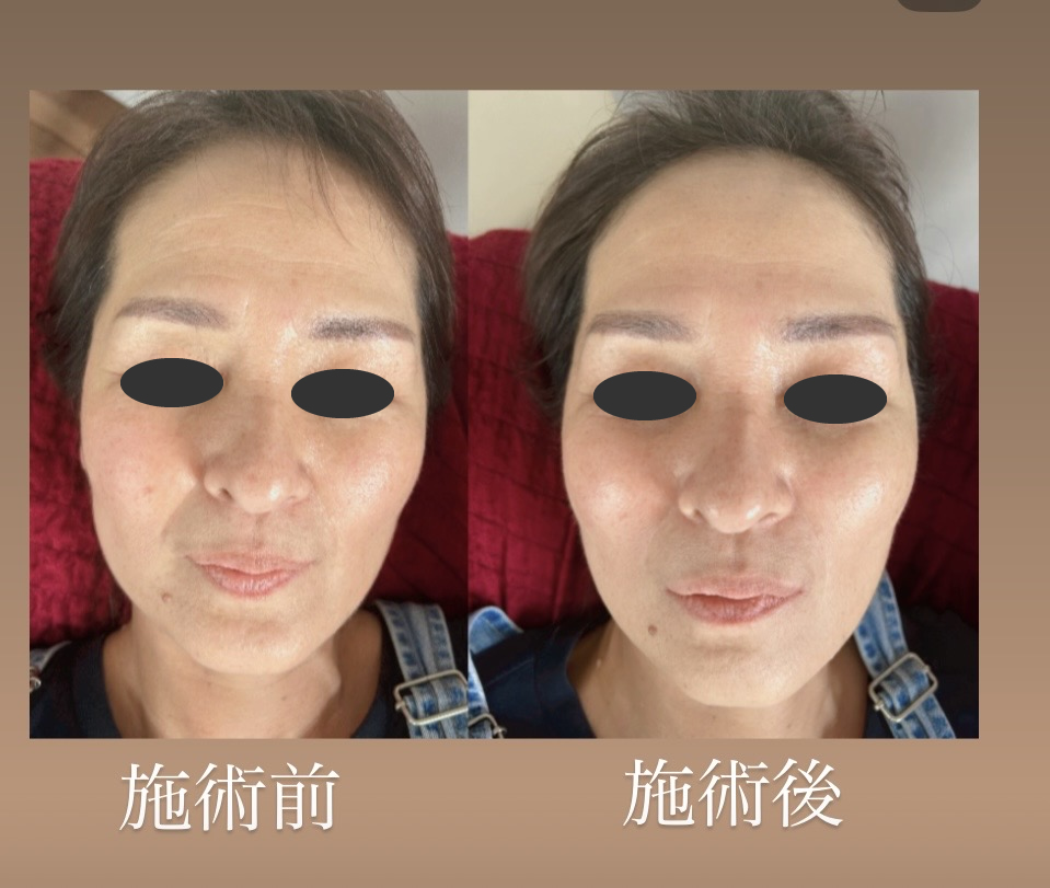 訪問美容医療の力で、できるケアをあきらめない